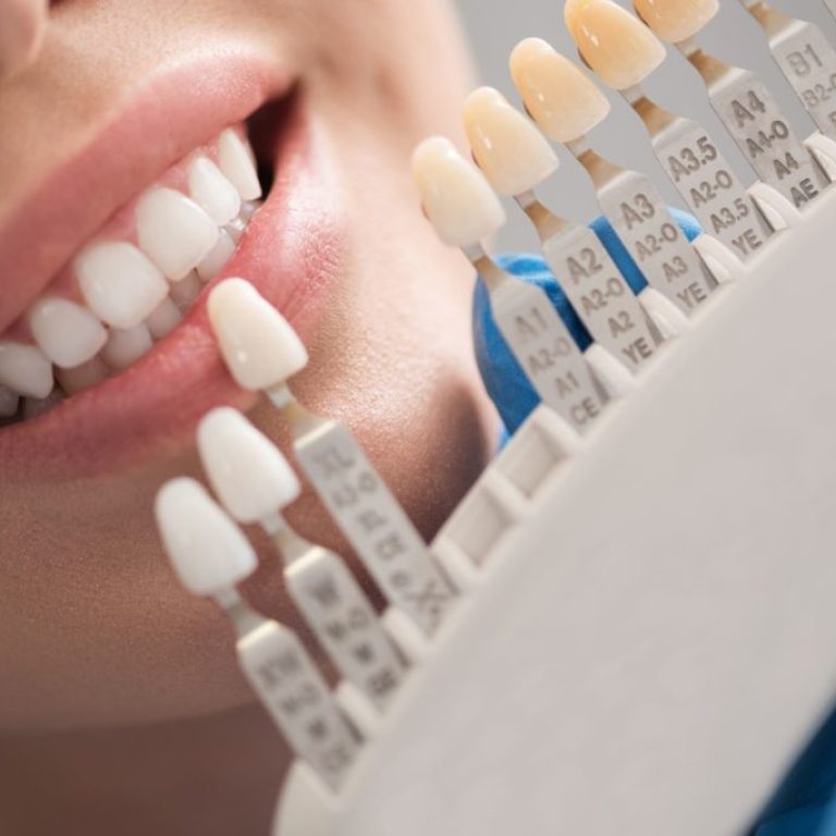 protesi-dentali-fisse-e-mobili-1-1024x684